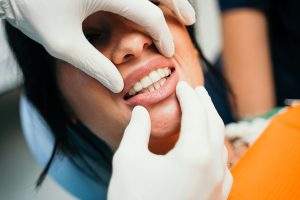 invisalign a rimini