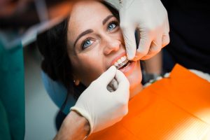 invisalign a rimini costi